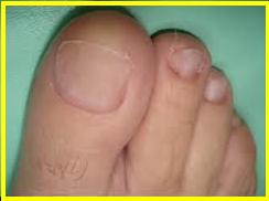 acrilica